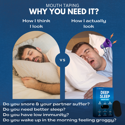 Dream Big™ Mouth Tape for Sleeping (30 Pack) Micropore Tape Hypoallergenic, Pain-Free Removal, Soft Medical Grade Fabric & Latex Free, Optimized Rest & Recovery, Stops Snoring with Better Nasal Breathing